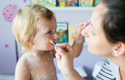 Sarampo cresce 32 vezes nas Américas em um ano; veja situação do Brasil