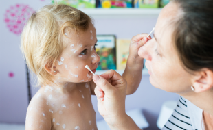 Sarampo cresce 32 vezes nas Américas em um ano; veja situação do Brasil